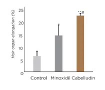 Minoxidil Cabelludin