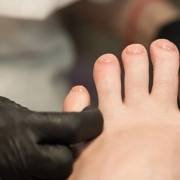 Professional applying care to toenails to check onychomycosis during a nail care session.