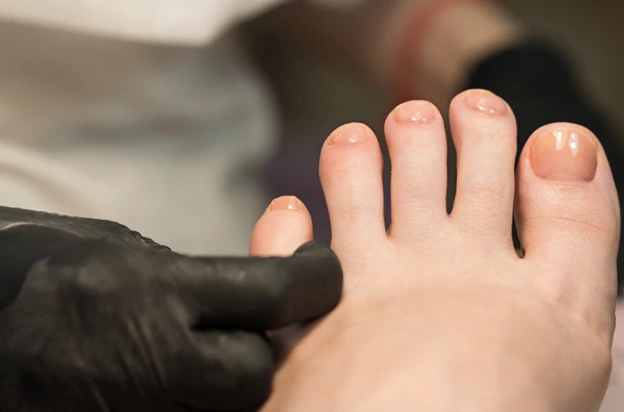 Professional applying care to toenails to check onychomycosis during a nail care session.