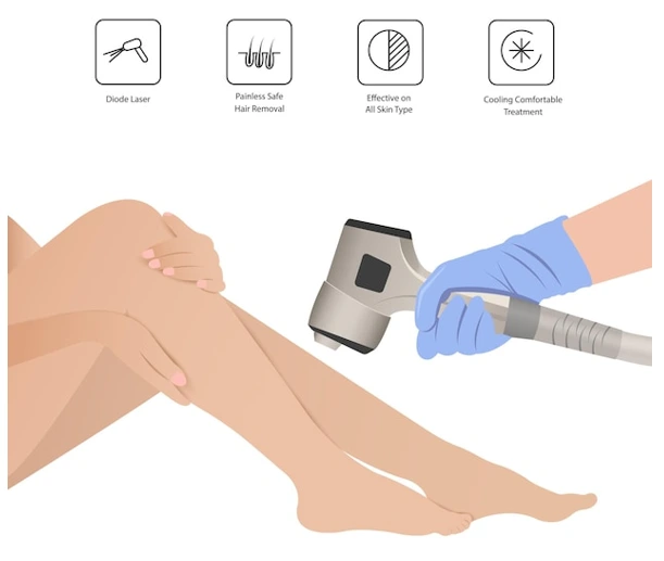 Illustration of laser hair removal on legs with diode laser benefits icons.